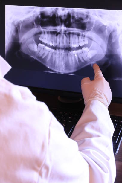 Best Urgent Care for Lost Fillings or Crowns in St Leo, FL